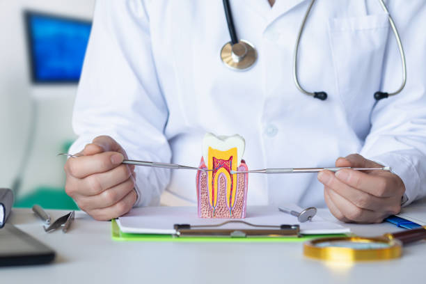 Best Knocked-Out Tooth (Avulsed Tooth) Treatment in Maxwell, CA