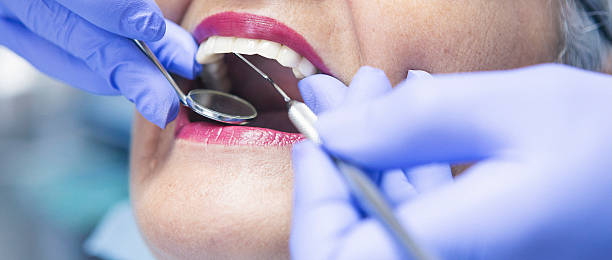 Best Emergency Wisdom Tooth Extraction in Maxwell, CA