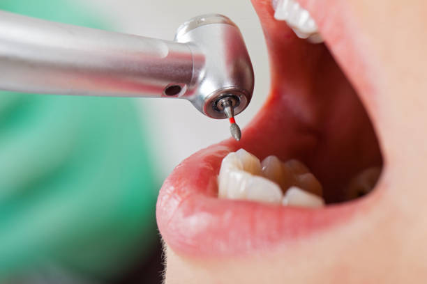 Best After-Hours Dental Care in Maxwell, CA